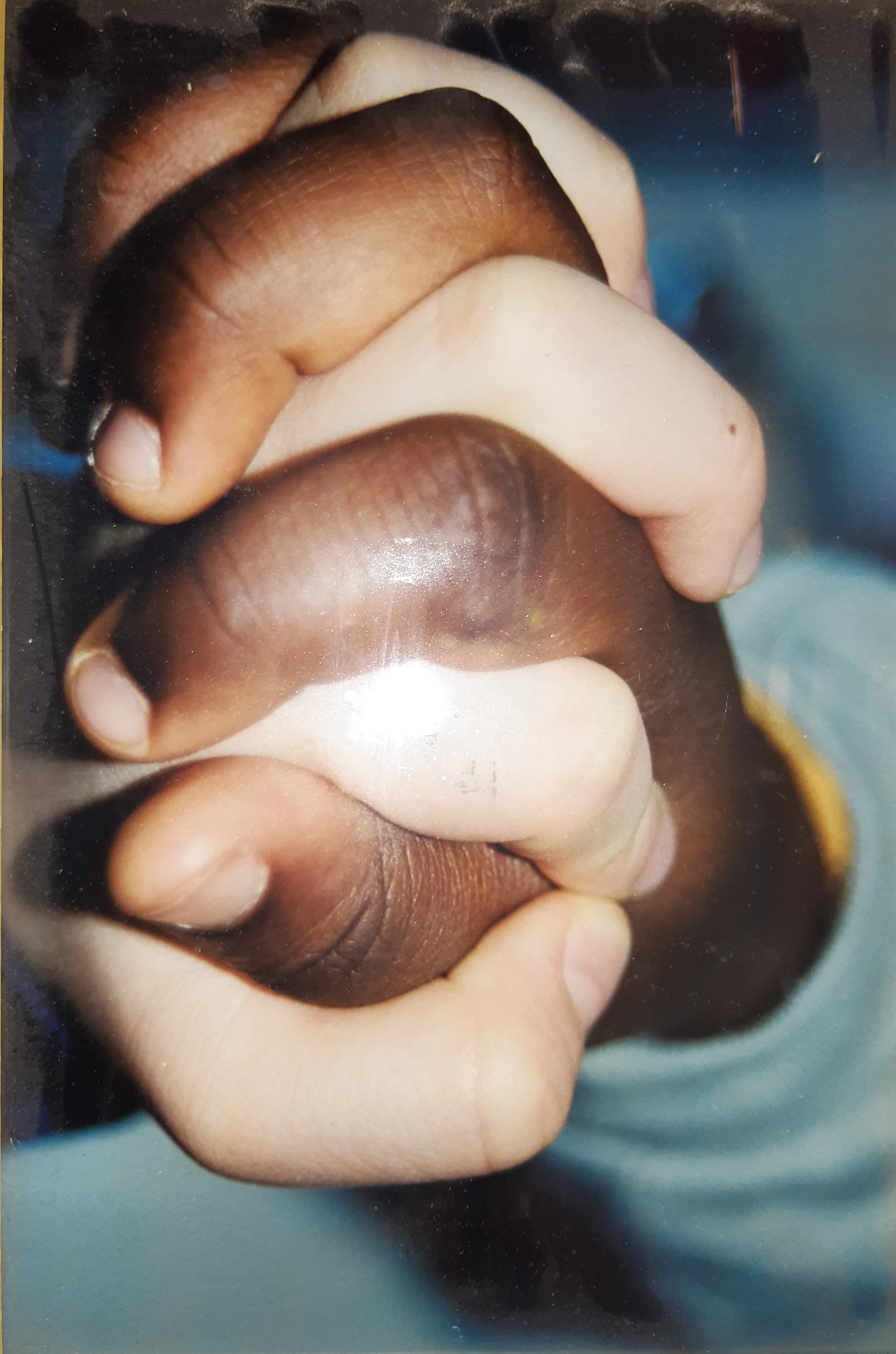  Hände verschiedener Hautfarben ineinander verschlungen, Symbol für Einheit und Vielfalt.